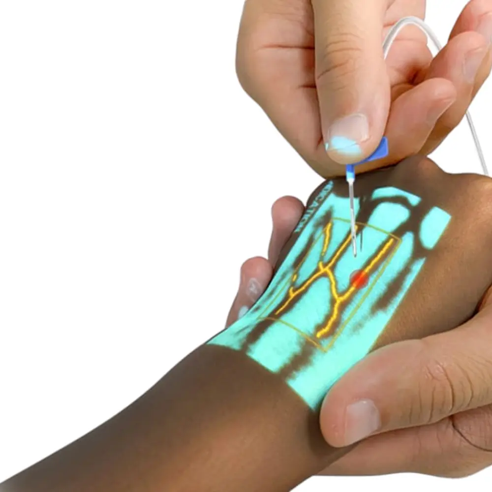 VS500 Infrared Vein Viewer