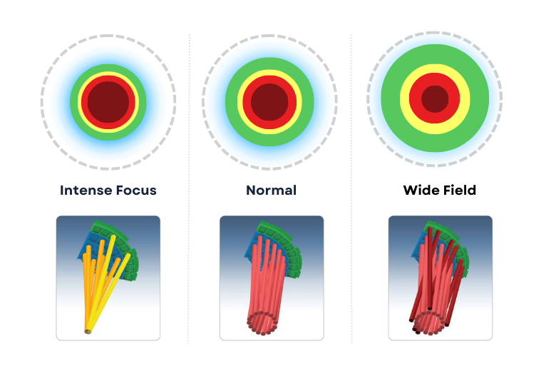 Uniform Intensity Illustration Illustration explaining how surgical lights maintain high intensity at different focus widths