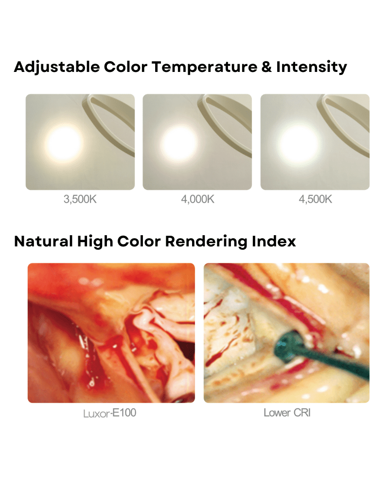 Luxor 100 Series Procedure Lights