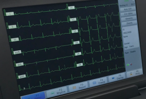 ekg machine screen with waveform
